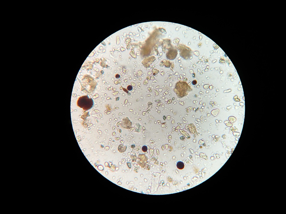 透過顯微鏡觀察的微生物培養樣本